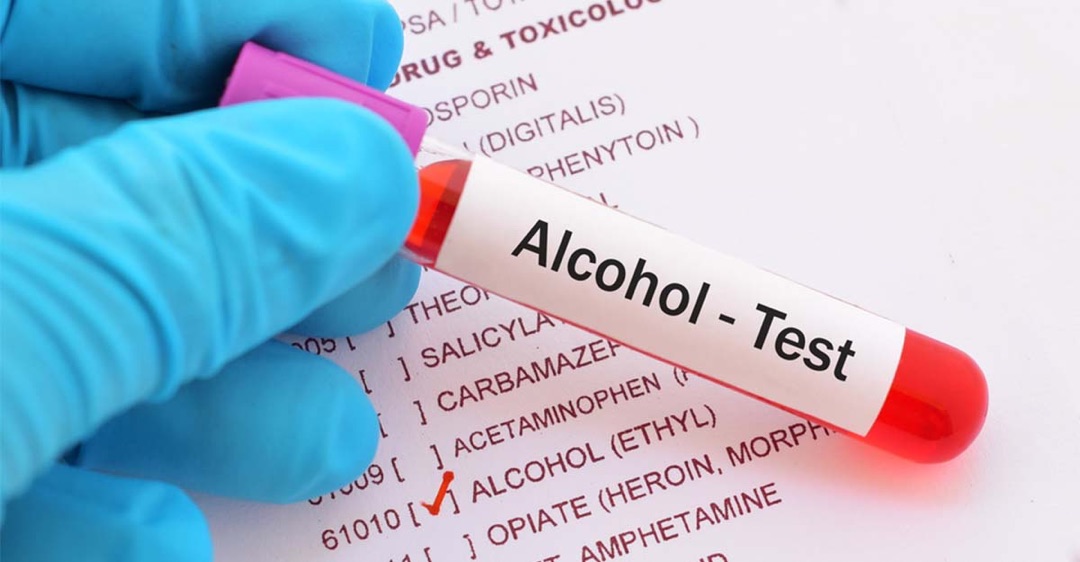 9 Benefits Of Drug & Alcohol Testing Programs For An Organization – Medbury Medical  Services